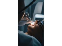 激光洗紋身全過程你了解嗎？